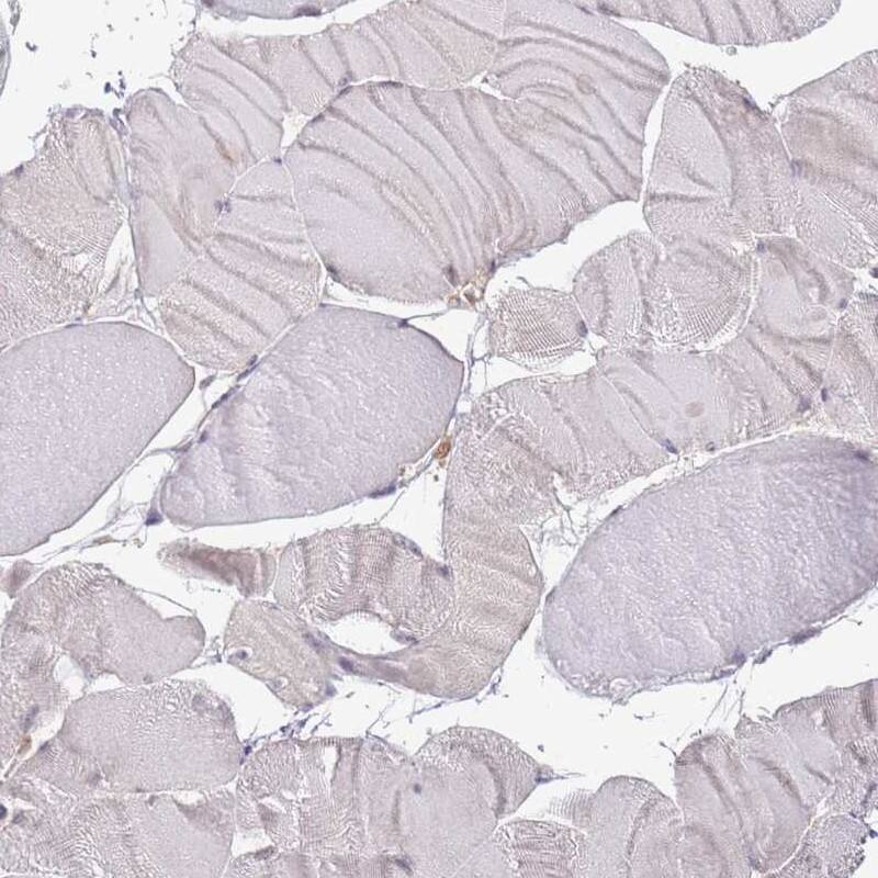 Lipin 2 Antibody - BSA Free Immunohistochemistry-Paraffin: Lipin 2 Antibody [NBP2-33931]