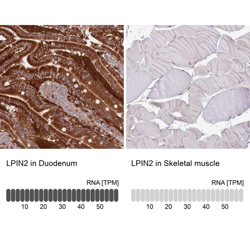 Lipin 2 Antibody - BSA Free Immunohistochemistry-Paraffin: Lipin 2 Antibody [NBP2-33931]