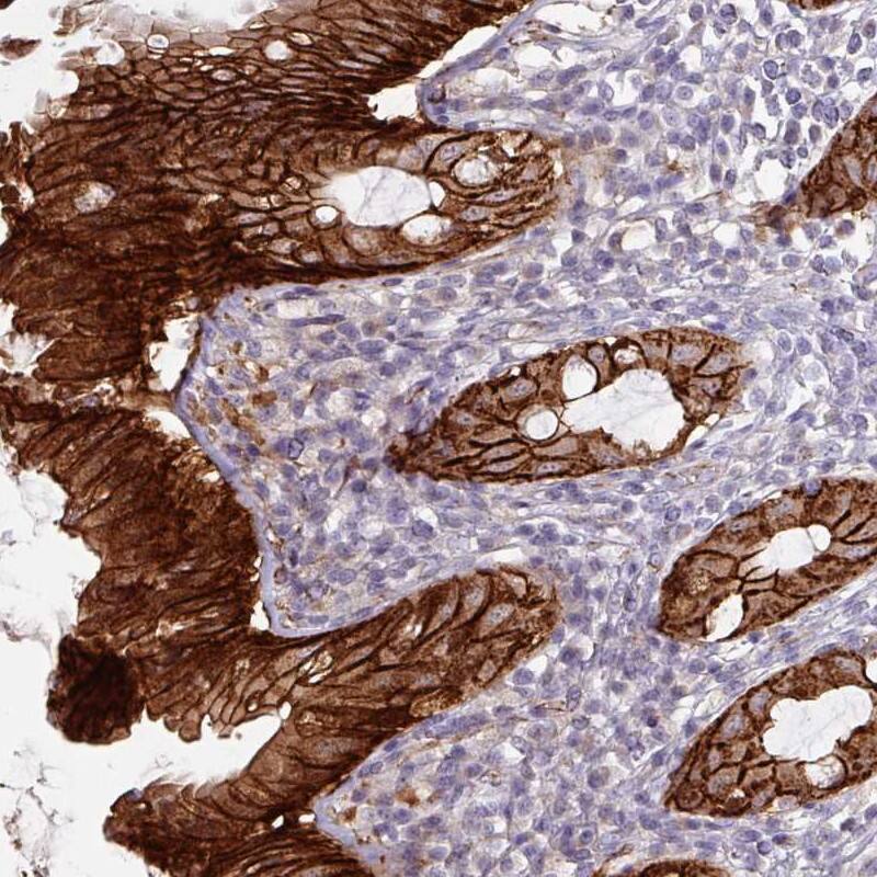 gamma Catenin Antibody - BSA Free Immunohistochemistry-Paraffin: gamma Catenin Antibody [NBP2-33965]