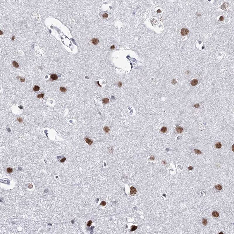 ZC3H8 Antibody - BSA Free Immunohistochemistry-Paraffin: ZC3H8 Antibody [NBP2-33980]