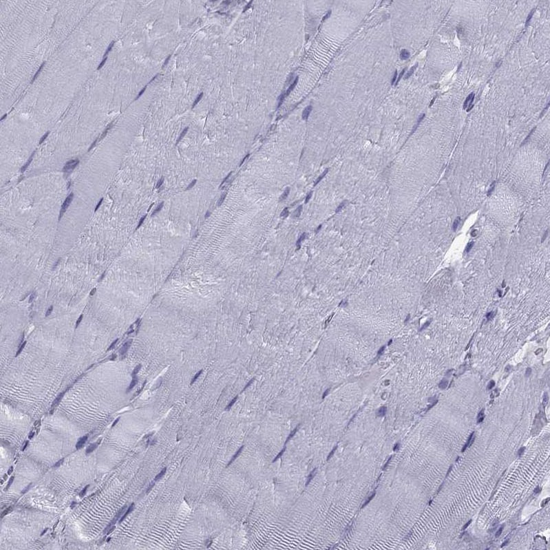 TFF3 Antibody - BSA Free Immunohistochemistry-Paraffin: TFF3 Antibody [NBP2-34007]