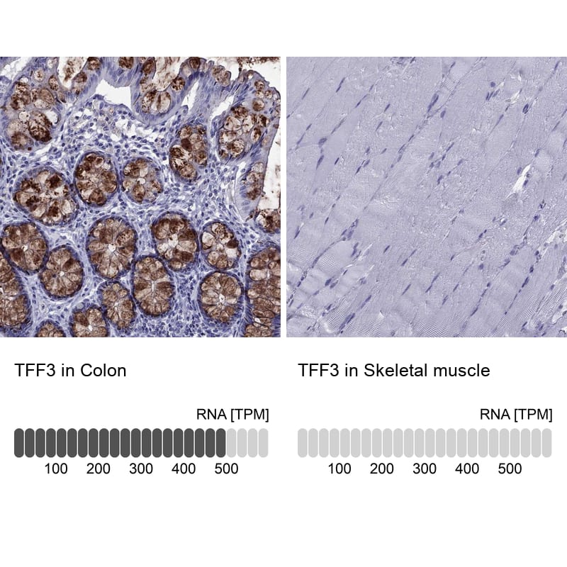 TFF3 Antibody - BSA Free Immunohistochemistry-Paraffin: TFF3 Antibody [NBP2-34007]