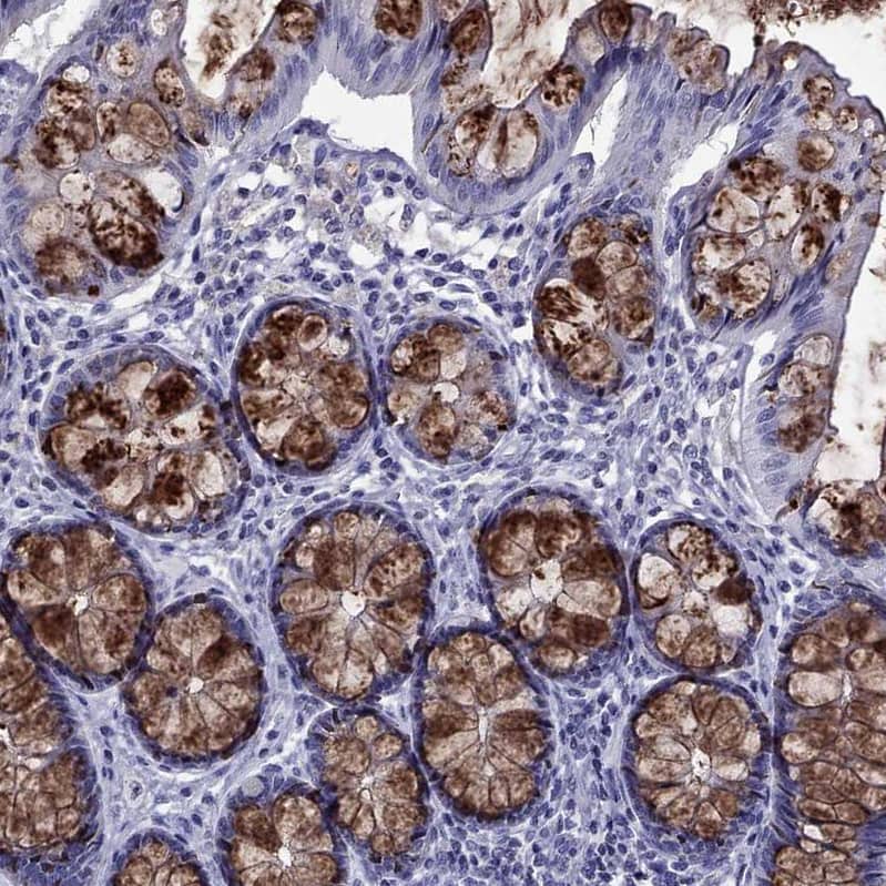 TFF3 Antibody - BSA Free Immunohistochemistry-Paraffin: TFF3 Antibody [NBP2-34007]