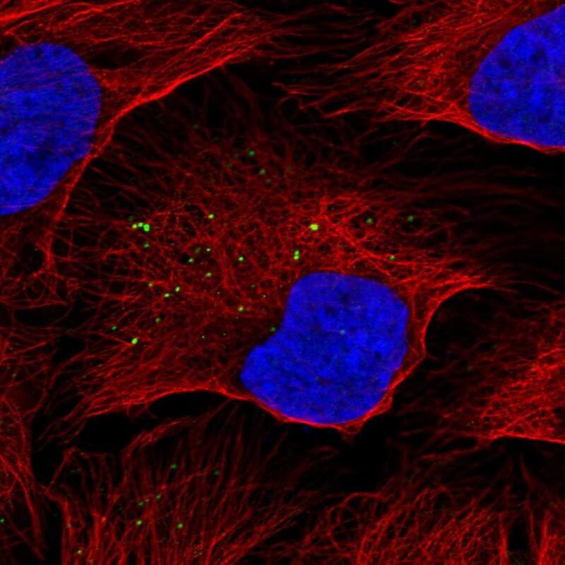 KISS1 Antibody - BSA Free Immunocytochemistry/ Immunofluorescence: KISS1 Antibody [NBP2-34010]