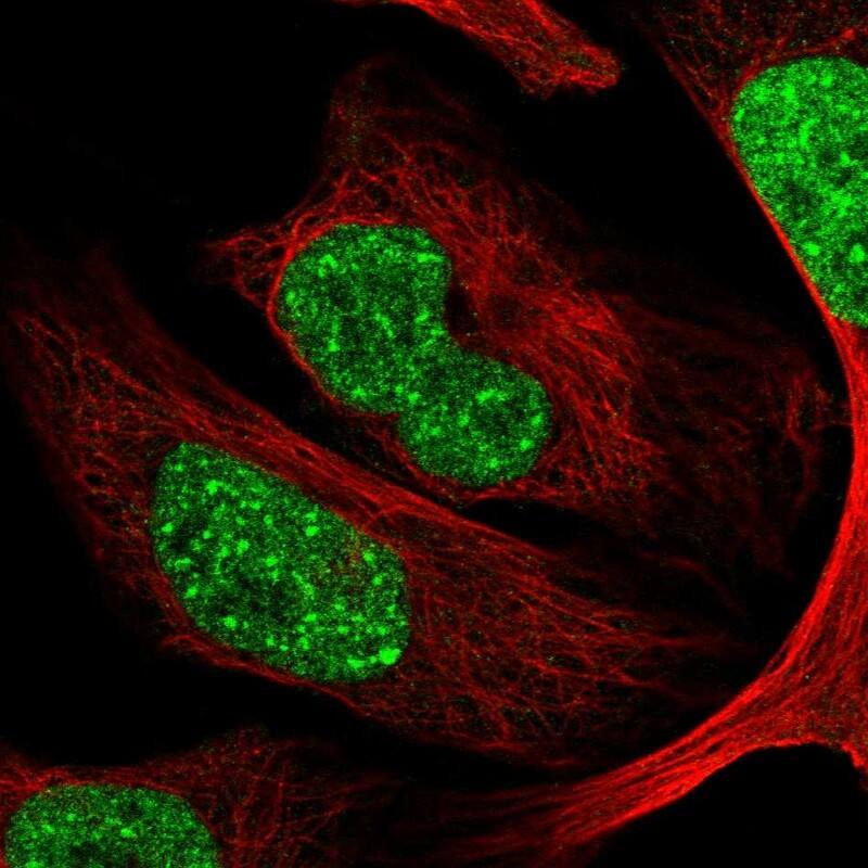 CDYL Antibody - BSA Free Immunocytochemistry/ Immunofluorescence: CDYL Antibody [NBP2-34011]