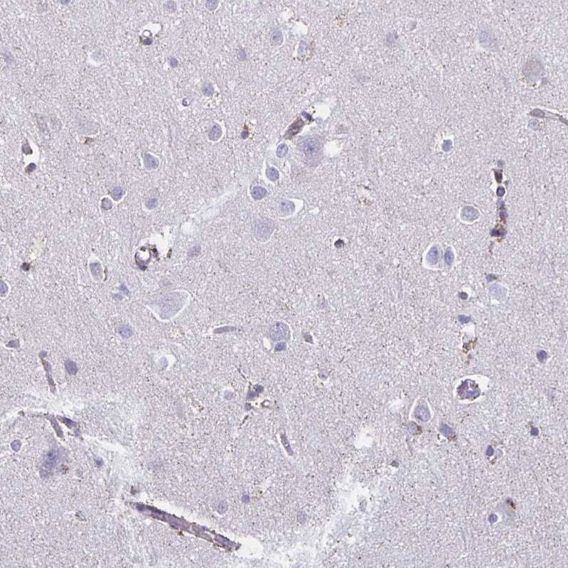 Thyrotropin Releasing Hormone Antibody - BSA Free Immunohistochemistry-Paraffin: Thyrotropin Releasing Hormone Antibody [NBP2-34014]
