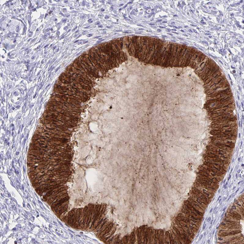 Thyrotropin Releasing Hormone Antibody - BSA Free Immunohistochemistry-Paraffin: Thyrotropin Releasing Hormone Antibody [NBP2-34014]