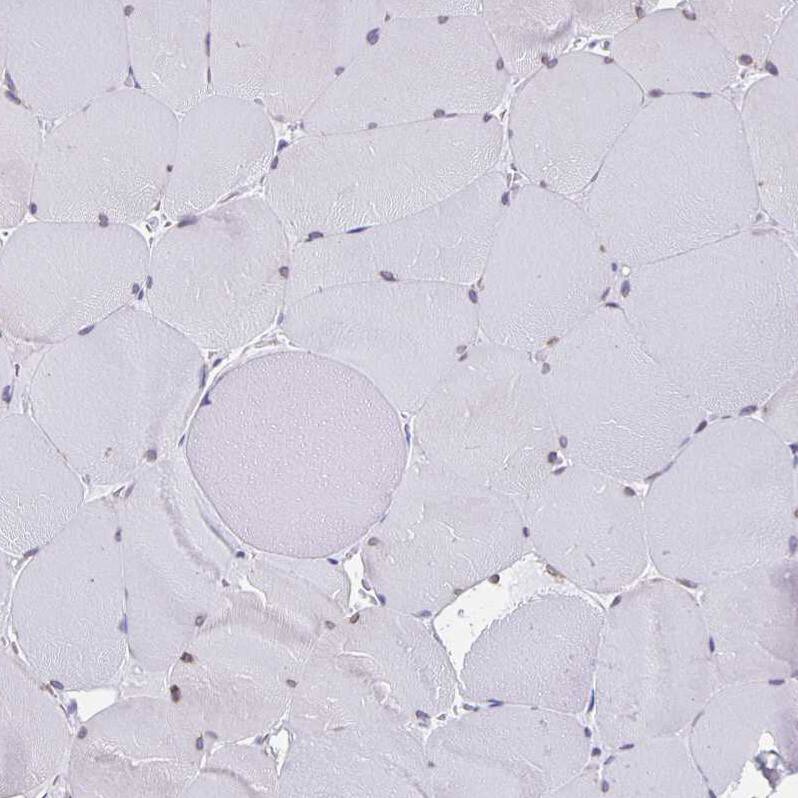 Thyrotropin Releasing Hormone Antibody - BSA Free Immunohistochemistry-Paraffin: Thyrotropin Releasing Hormone Antibody [NBP2-34014]
