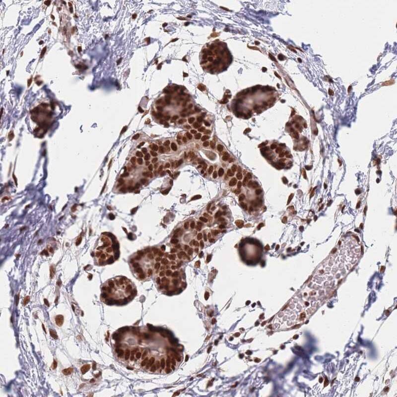 Spt6 Antibody - BSA Free Immunohistochemistry-Paraffin: Spt6 Antibody [NBP2-34030]