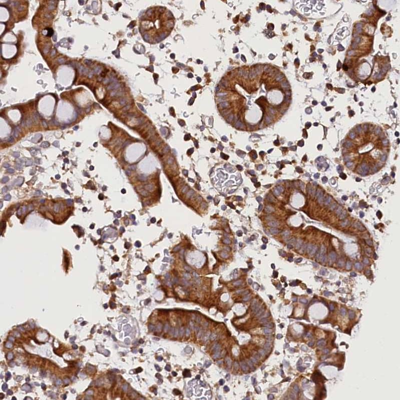 SUV3L1 Antibody - BSA Free Immunohistochemistry-Paraffin: SUV3L1 Antibody [NBP2-34047]