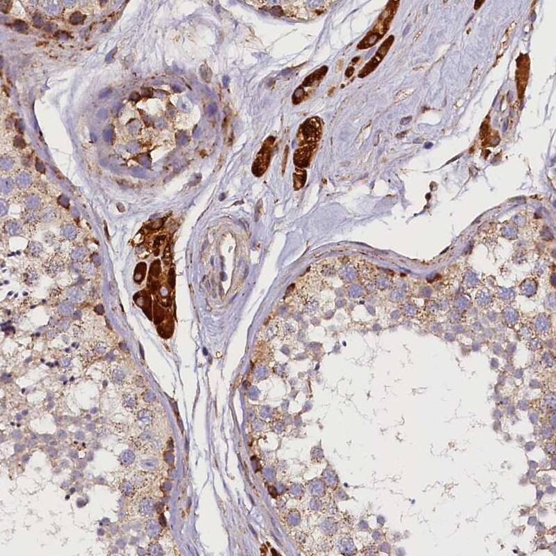 SUV3L1 Antibody - BSA Free Immunohistochemistry-Paraffin: SUV3L1 Antibody [NBP2-34047]