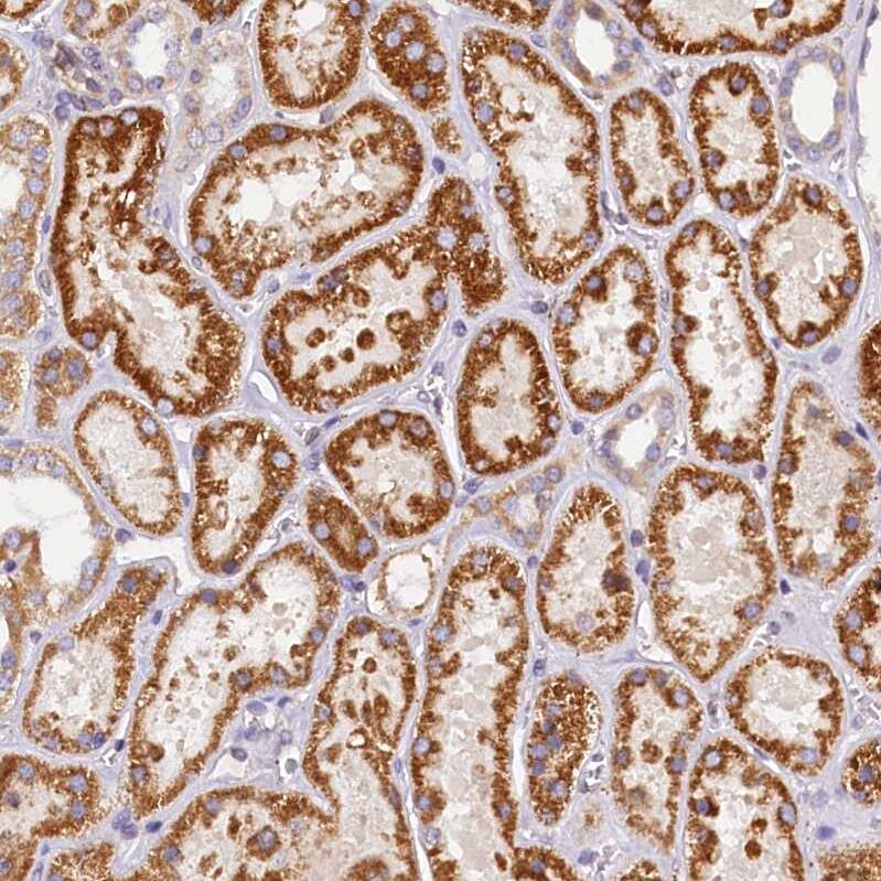 SUV3L1 Antibody - BSA Free Immunohistochemistry-Paraffin: SUV3L1 Antibody [NBP2-34047]