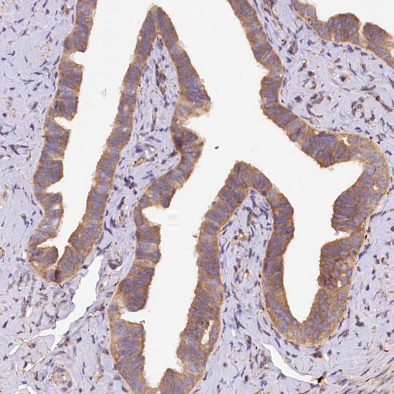 SUV3L1 Antibody - BSA Free Immunohistochemistry-Paraffin: SUV3L1 Antibody [NBP2-34047]