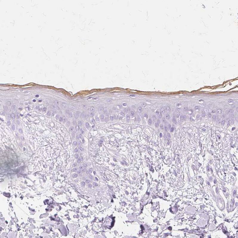 Transglutaminase 1/TGM1 Antibody - BSA Free Immunohistochemistry-Paraffin: Transglutaminase 1/TGM1 Antibody [NBP2-34062]