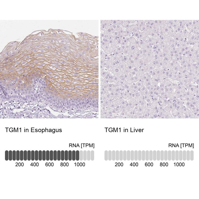 Transglutaminase 1/TGM1 Antibody - BSA Free Immunohistochemistry-Paraffin: Transglutaminase 1/TGM1 Antibody [NBP2-34062]