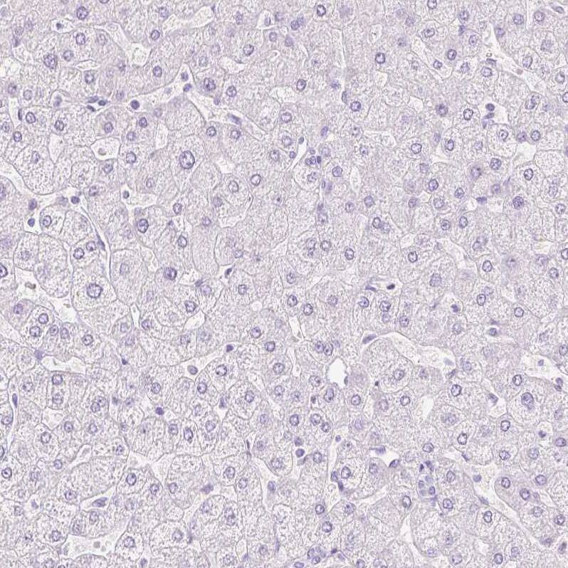 Transglutaminase 1/TGM1 Antibody - BSA Free Immunohistochemistry-Paraffin: Transglutaminase 1/TGM1 Antibody [NBP2-34062]