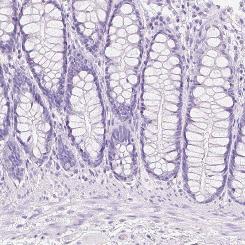 Transglutaminase 1/TGM1 Antibody - BSA Free Immunohistochemistry-Paraffin: Transglutaminase 1/TGM1 Antibody [NBP2-34062]