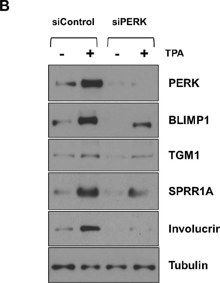 Transglutaminase 1/TGM1 Antibody - BSA Free