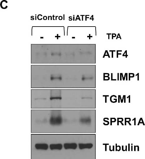 Transglutaminase 1/TGM1 Antibody - BSA Free