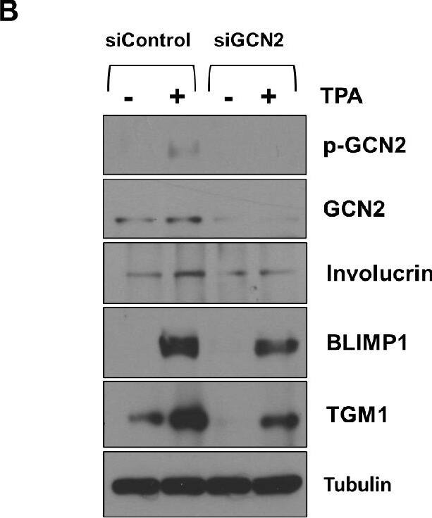 Transglutaminase 1/TGM1 Antibody - BSA Free