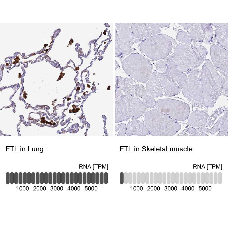 Ferritin Light Chain Antibody - BSA Free Immunohistochemistry-Paraffin: Ferritin Light Chain Antibody [NBP2-34072]