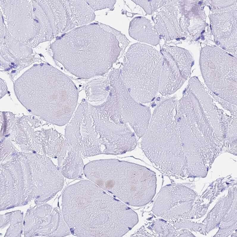 Ferritin Light Chain Antibody - BSA Free Immunohistochemistry-Paraffin: Ferritin Light Chain Antibody [NBP2-34072]