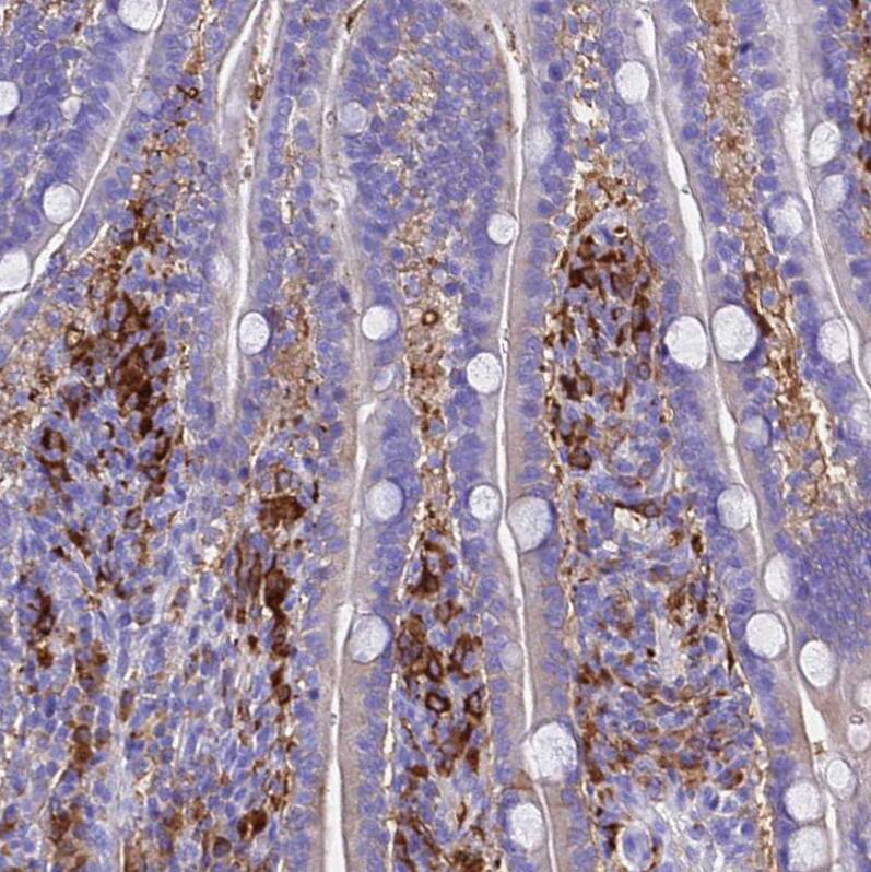 Ferritin Light Chain Antibody - BSA Free Immunohistochemistry-Paraffin: Ferritin Light Chain Antibody [NBP2-34072]