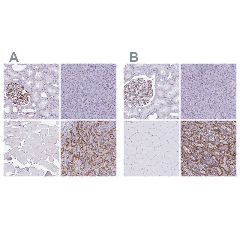 PITPNM3 Antibody Immunohistochemistry-Paraffin: PITPNM3 Antibody Antibody [NBP2-34121]