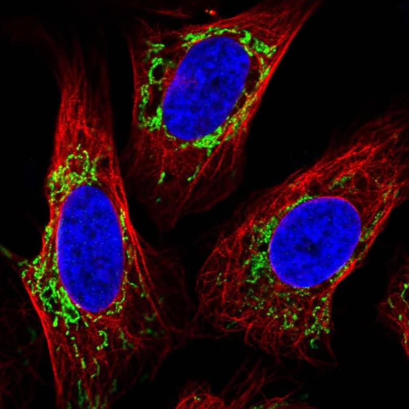 TMEM246 Antibody - BSA Free Immunocytochemistry/ Immunofluorescence: TMEM246 Antibody [NBP2-34188]