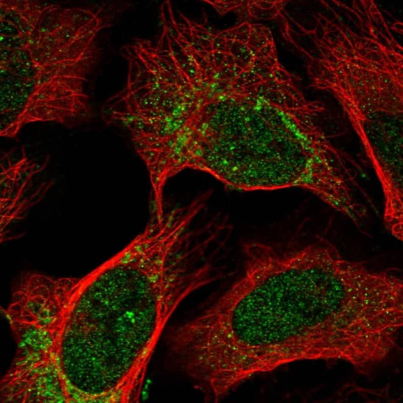 OPA1 Antibody - BSA Free Immunocytochemistry/ Immunofluorescence: OPA1 Antibody [NBP2-34206]