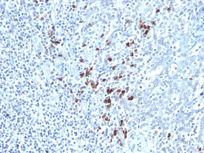 Kappa Light Chain Antibody (KLC264) Immunohistochemistry-Paraffin: Kappa Light Chain Antibody (KLC264) [NBP2-34255] -
