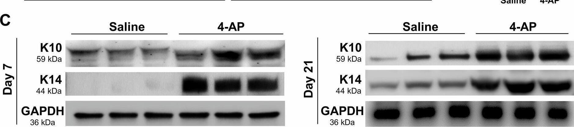 Cytokeratin 14 Antibody (LL002)