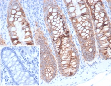 EpCAM/TROP1 Antibody (323/A3) - (ECD)