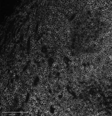 CD45 Antibody (2B11 + PD7/26)