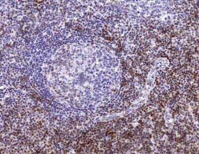 CD5 Antibody (C5/473 + CD5/54/F6)