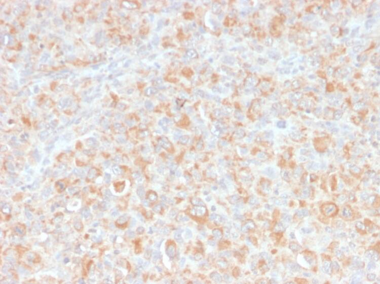 TNF-alpha Antibody (SPM543) Immunohistochemistry-Paraffin: TNF-alpha Antibody (SPM543) [NBP2-34372] -