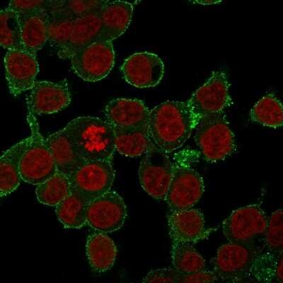 TNF-alpha Antibody (SPM543) - Azide and BSA Free Immunocytochemistry/ Immunofluorescence: TNF-alpha Antibody (SPM543) - Azide and BSA Free [NBP2-34419] -