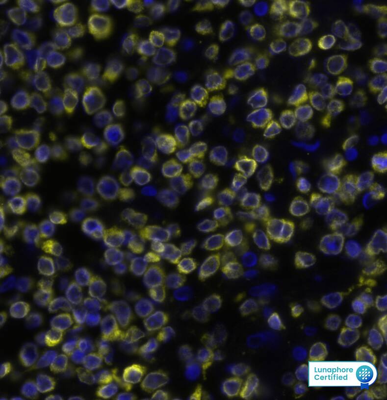 Bcl-2 Antibody (124) Detection of BCL2 in Human Non-Hodgkin’s Lymphoma via seqIF™ staining on COMET™