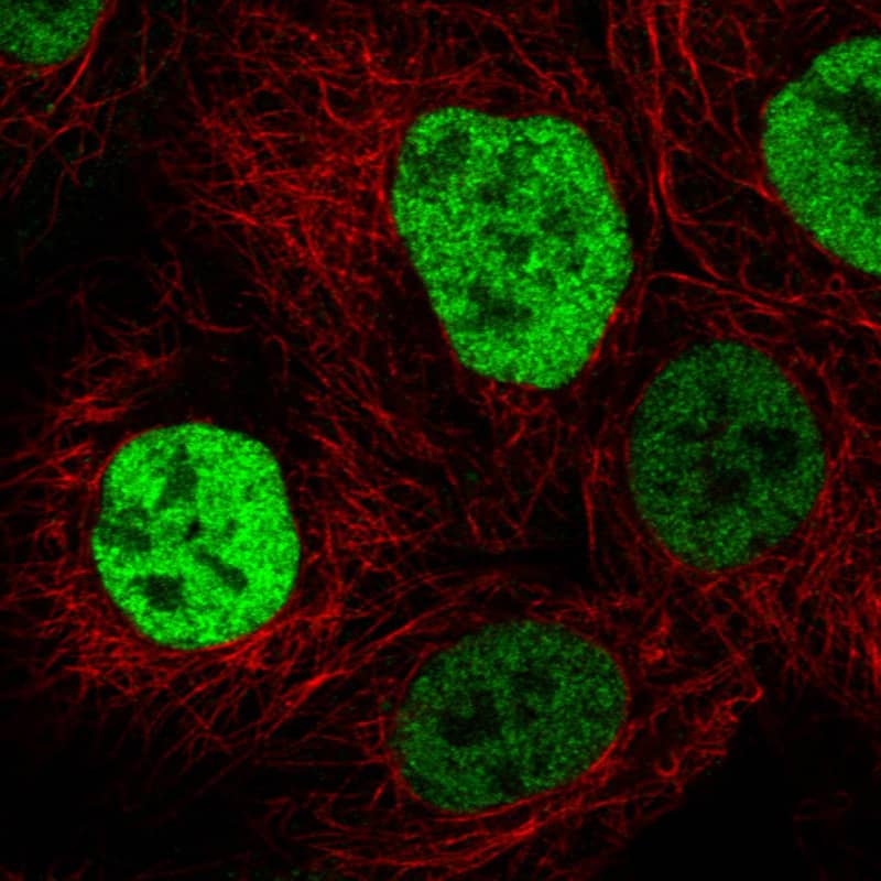 p53 Antibody (CL2199) - BSA Free Immunocytochemistry/ Immunofluorescence: p53 Antibody (CL2199) [NBP2-34495]