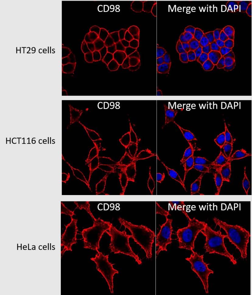 CD98 Antibody (UM7F8) - Azide and BSA Free Immunocytochemistry/ Immunofluorescence: CD98 Antibody (UM7F8) - Azide and BSA Free [NBP2-34506] -