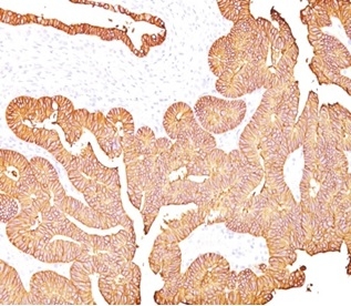 EpCAM/TROP1 Antibody (323/A3) - (ECD) - Azide and BSA Free