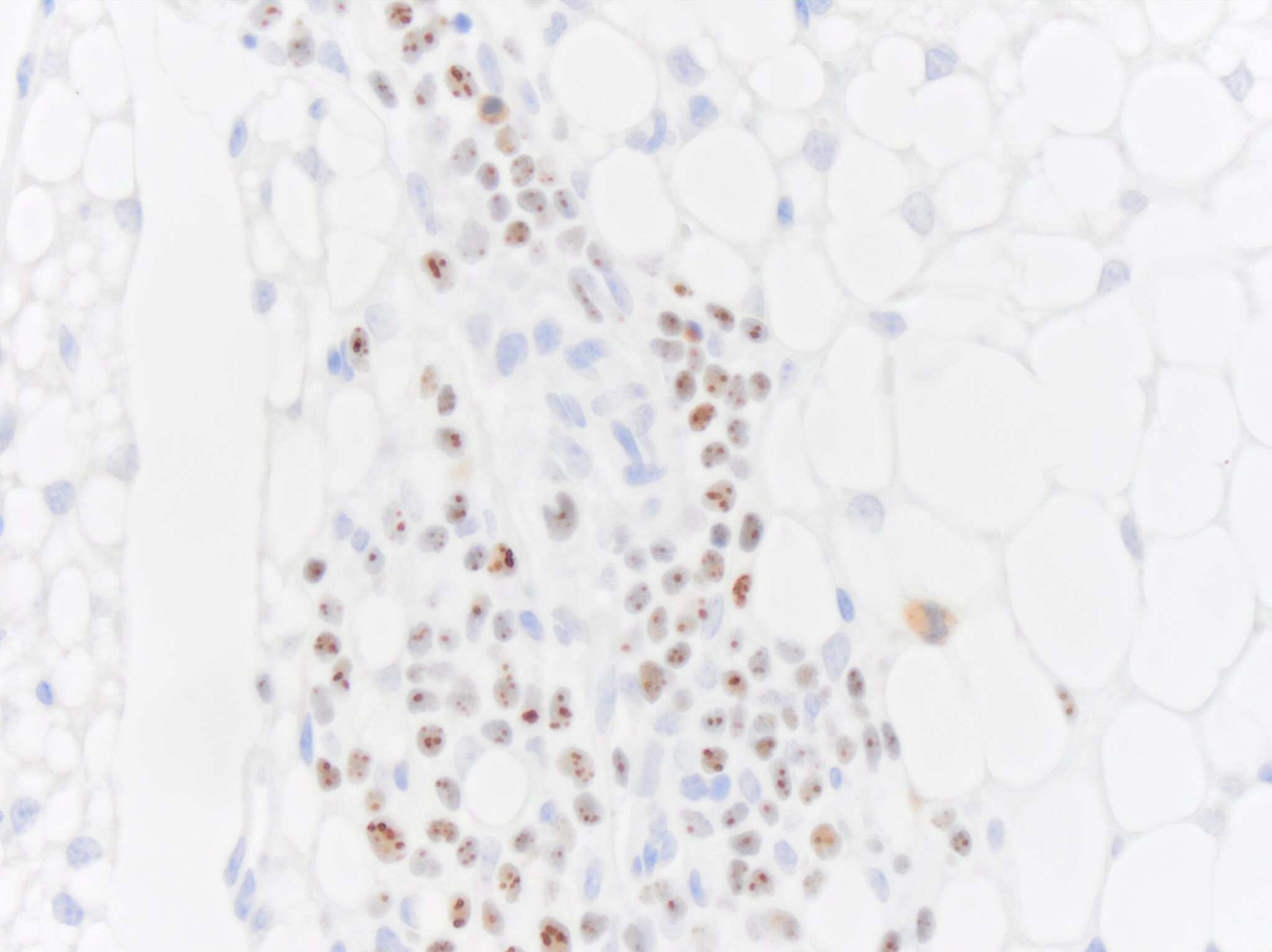 Nucleoli Marker Antibody (NM95) [Biotin]
