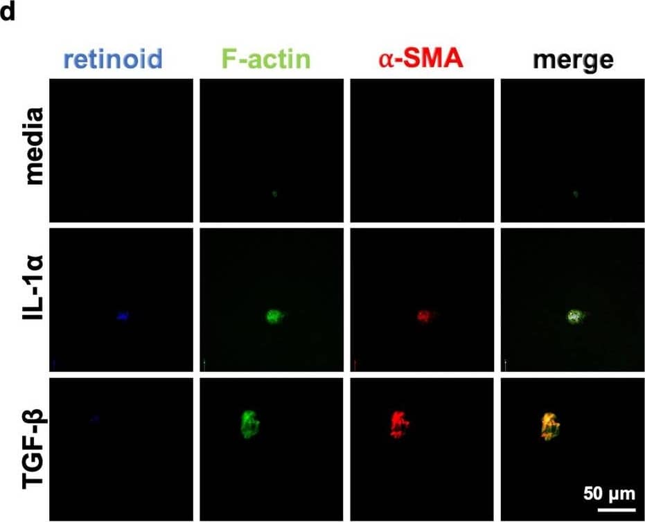 alpha-Smooth Muscle Actin Antibody (SPM332) [Allophycocyanin]