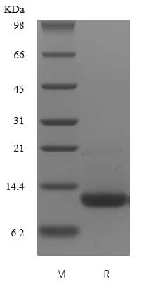 Recombinant Mouse CXCL16 Protein