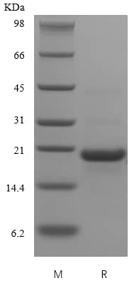 Recombinant Human CD23/Fc epsilon RII Protein