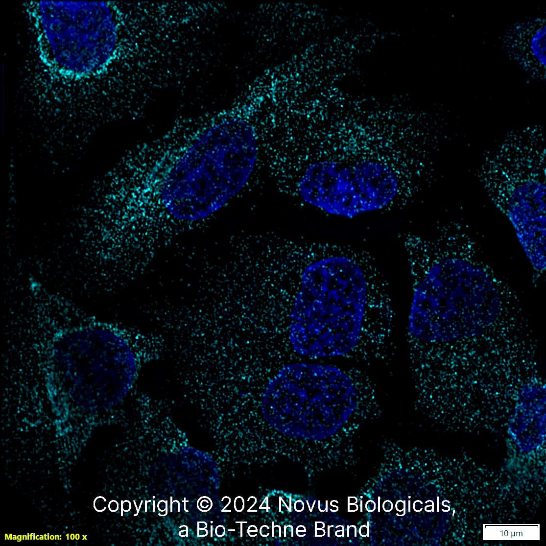 Calnexin Antibody (1C2.2D11) [Alexa Fluor® 647]