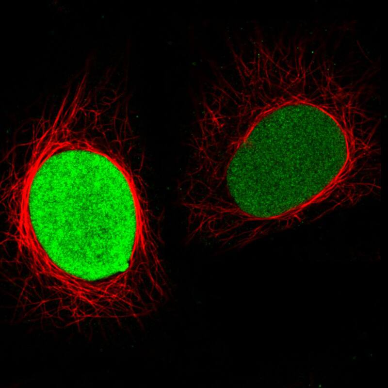 PARP Antibody (CL2220) - BSA Free Immunocytochemistry/ Immunofluorescence: PARP Antibody (CL2220) [NBP2-36747]