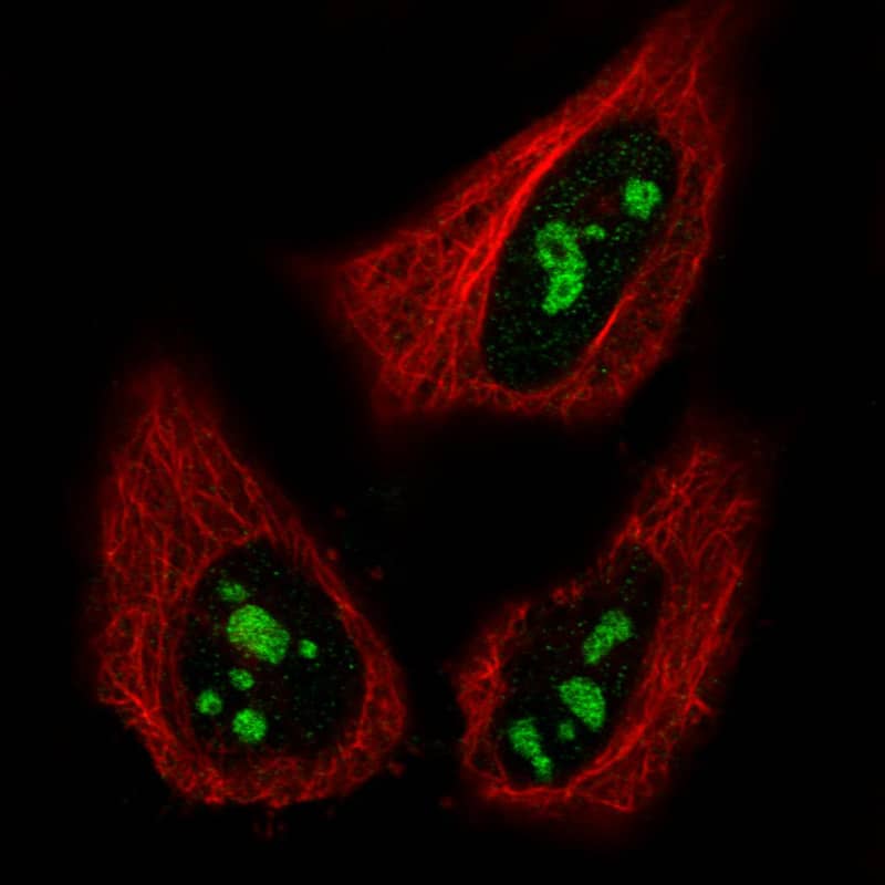 NIFK Antibody (CL2240) - BSA Free Immunocytochemistry/ Immunofluorescence: NIFK Antibody (CL2240) [NBP2-36749]