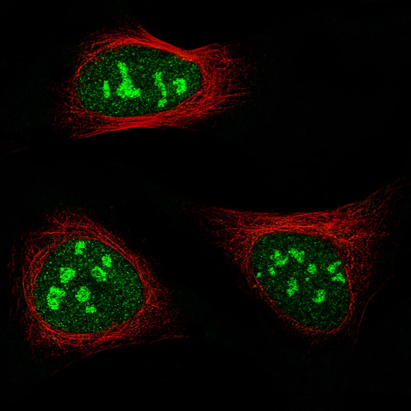 NIFK Antibody (CL2237) - BSA Free Immunocytochemistry/ Immunofluorescence: NIFK Antibody (CL2237) [NBP2-36750]