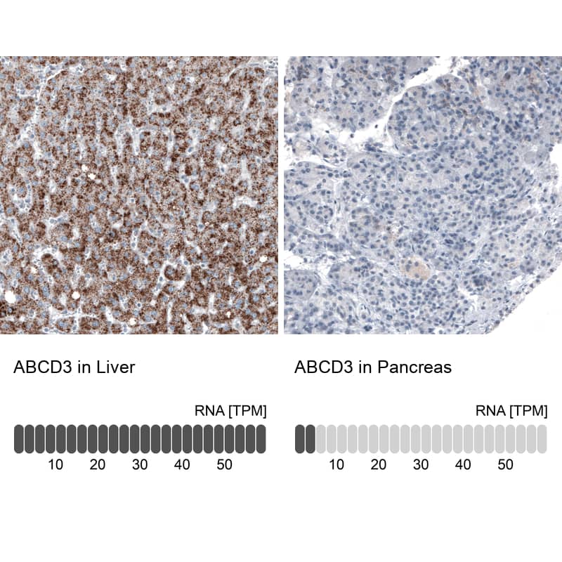 PMP70 Antibody (CL2524) - BSA Free Immunohistochemistry: PMP70 Antibody (CL2524) [NBP3-52459]